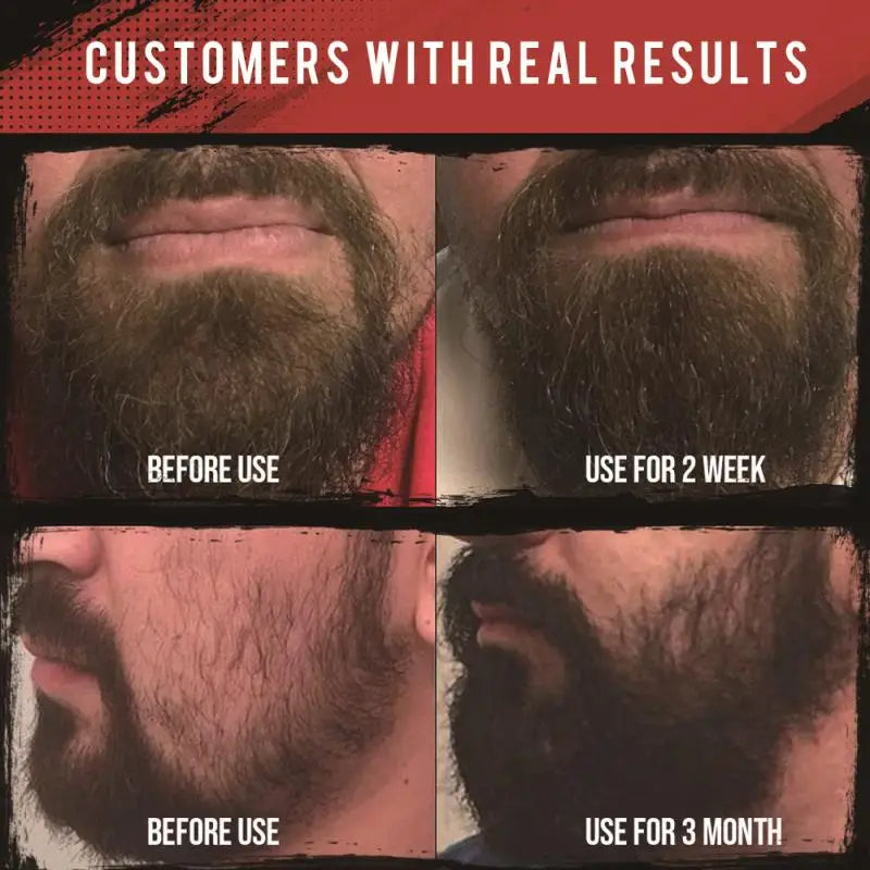 OEM Beard Growth Softens Strengthens Beards and Mustaches Beard Oil Set